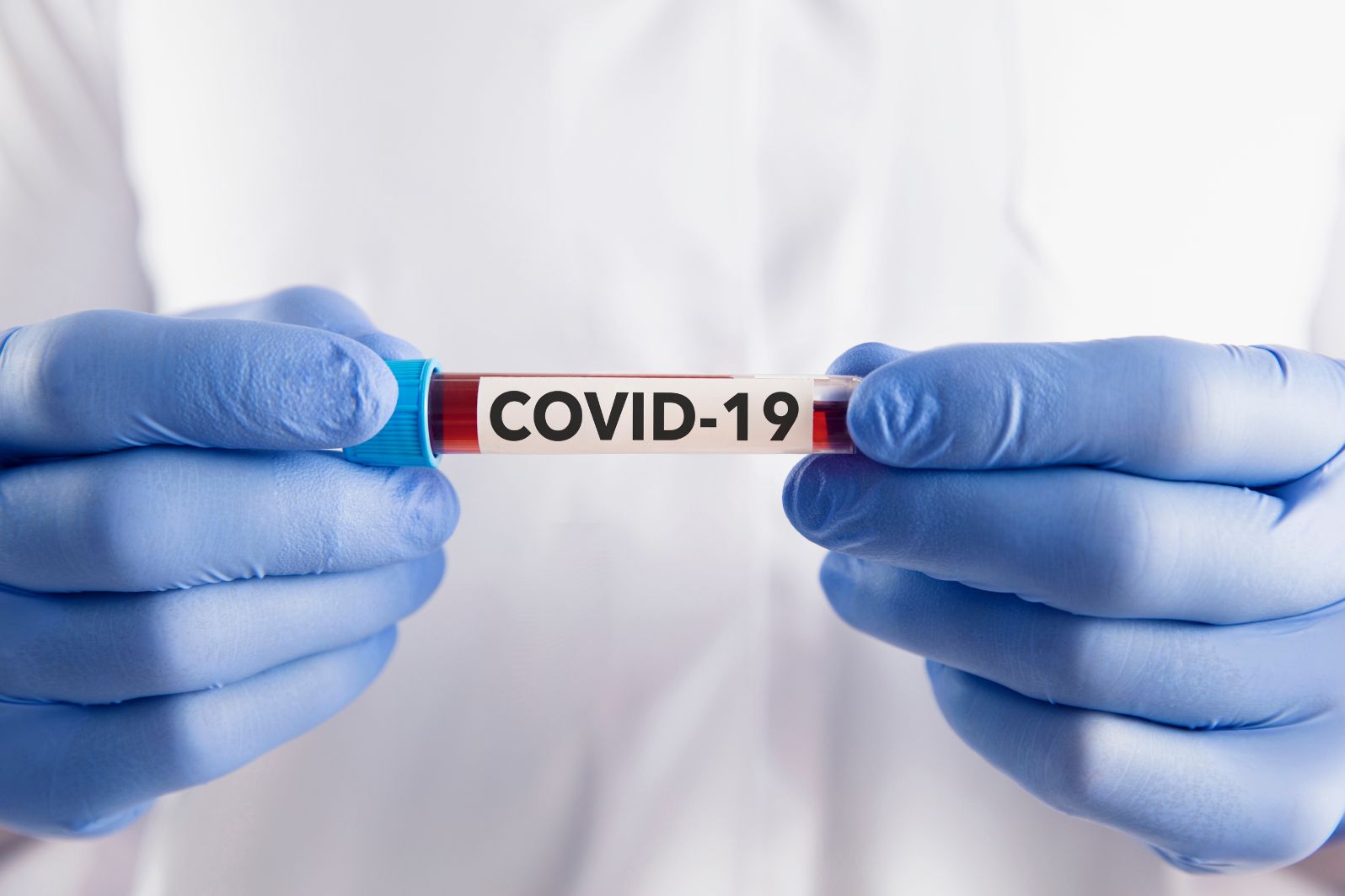 covid-19 test results online with sample id andhra pradesh